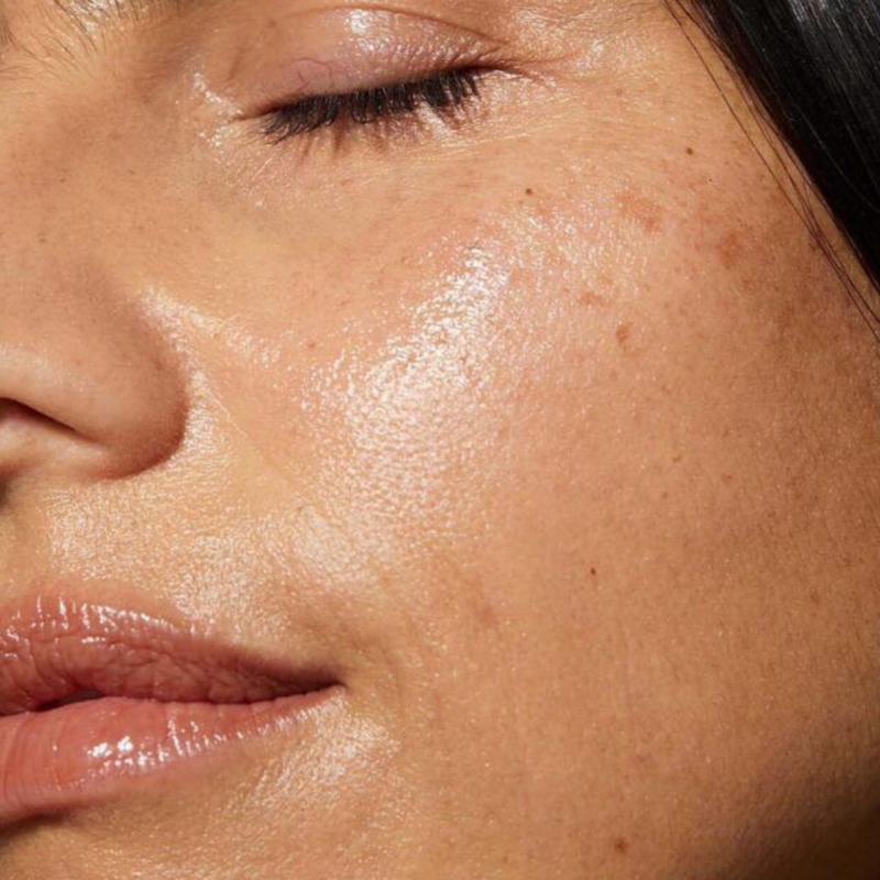 Oily Skin