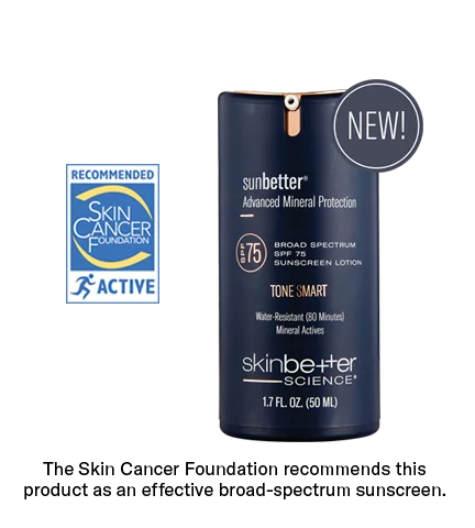 Skinbetter Science Tone Smart Lotion 75 SPF